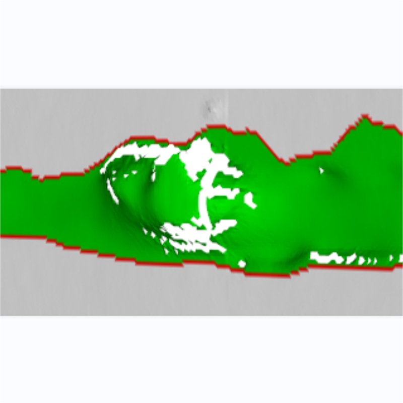 焊縫缺陷檢測(cè)系統(tǒng)——焊接質(zhì)量的智能衛(wèi)士