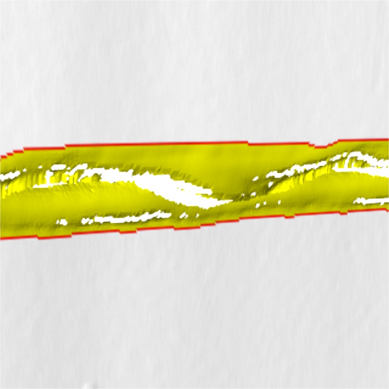 焊縫缺陷檢測(cè)系統(tǒng)——焊接質(zhì)量的智能衛(wèi)士